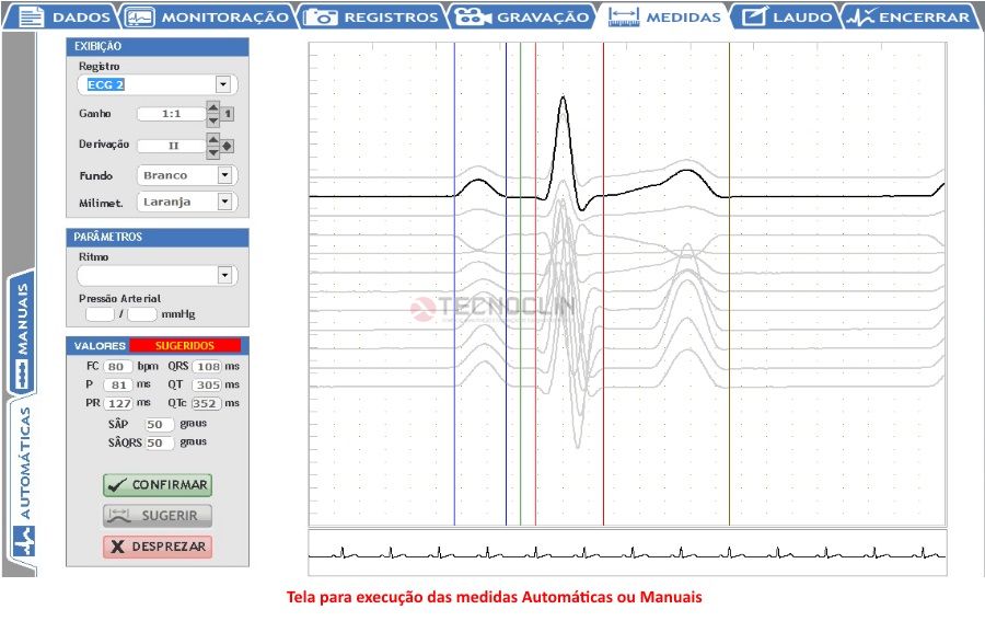 Exame de Tilt-Test : Tecnoclin Campinas/SP