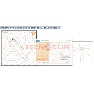 Mdulo de Vetorcardiografia para ECGPC