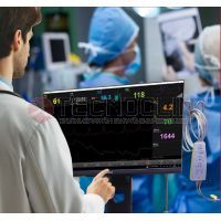 Monitor de Hemodinmica No Invasivo CardioScreen 1000